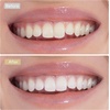 image:imageDermRays Lumenic Dual Light Electric Toothbrush Rechargeable GreyGrey